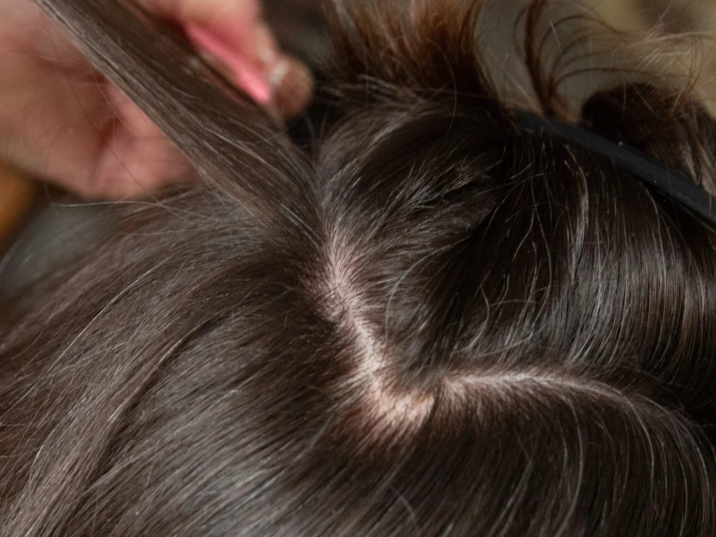 End of Summer Hair Care on the Main Line - Scalp TLC